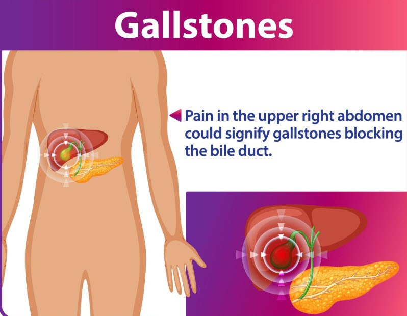 gallbladder