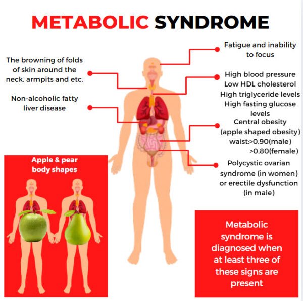 metabolic syndrome