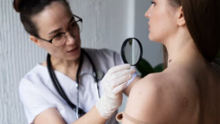 skin cancer2