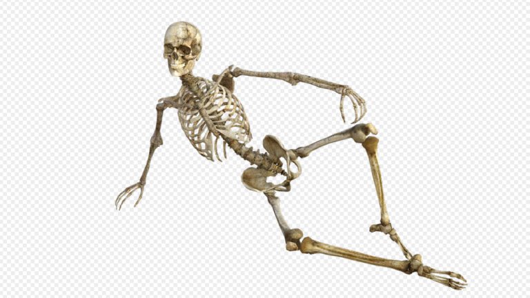 bone cancer