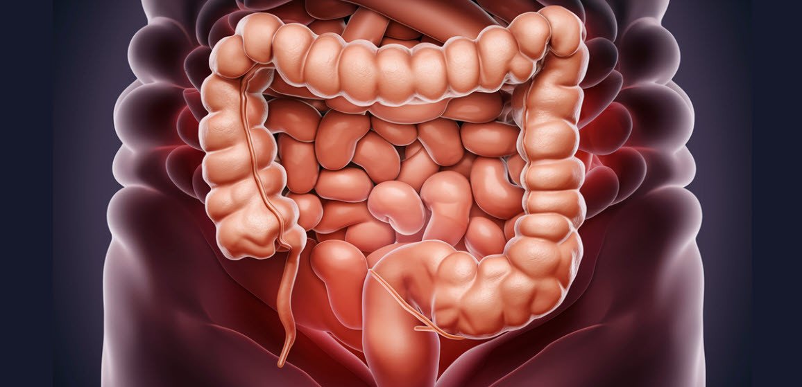 colon