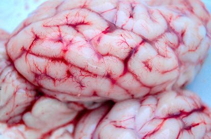 brain