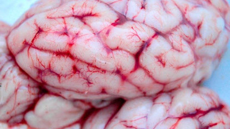 brain