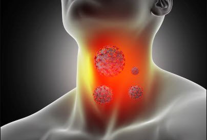 throat 2